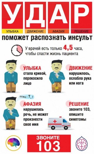 Симптомы инсульта: УДАР